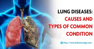 Lung Diseases: Types and Causes