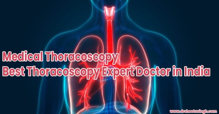 Medical Thoracoscopy Best Thoracoscopy Expert Doctor In India Dr