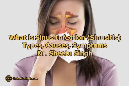 What is Sinus Infection (Sinusitis) Types, Causes, Symptoms - Dr ...