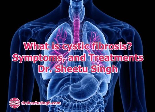 What is cystic fibrosis Symptoms, and Treatments - Dr. Sheetu Singh ...