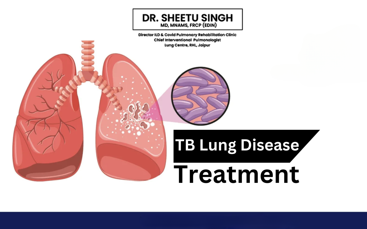 Tuberculosis-TB-Lung-Disease-and-Treatment-1200x750.png