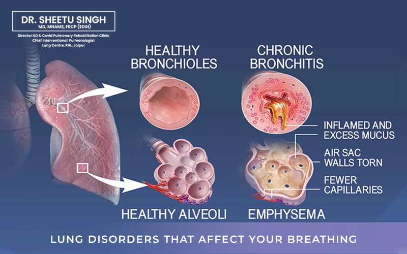 Lung-Disorders-Affect-Your-Breathing.png